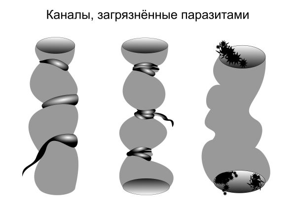 Каналы, загрязненные паразитами